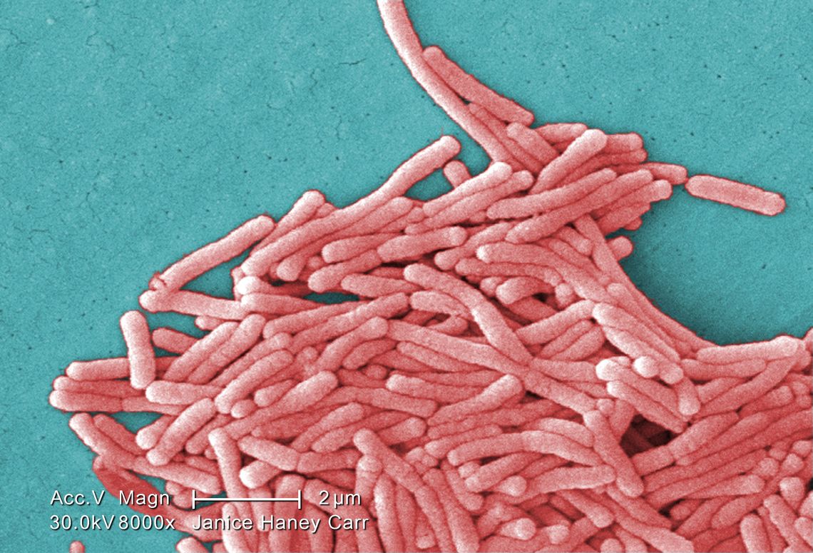 Bakteria legionella w Rzeszowie. Sanepid potwierdza zakażenie u 15 osób